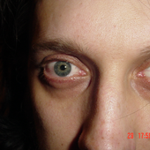 Avatar for mitoskalandiel