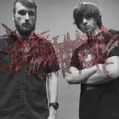 Shot Through The Hand With A Nail Gun