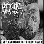 Empyema Drainage Of The Chest Cavity