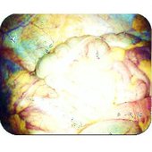 Occlusion
