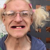 4 Teeth