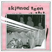 Skinned Teen