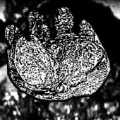Bronchospasm logo