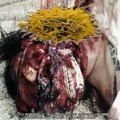 Parasitic Myoneuroma Of Sessile Pseudopolyps Similarly Concurrent Of Decubiteal-Like Ulcerous Inflammation