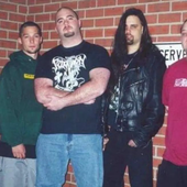 Cerebral Hemorrhage