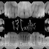 Serious Dental Work