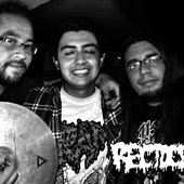 Rectocele