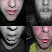 LIPS