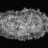 Hydroencephalocystocele logo