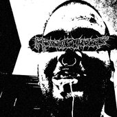 Mononuchleosis