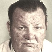 ROSACEA