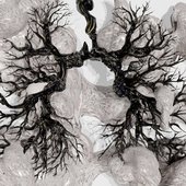 Sarcoidosis