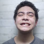 wiki2
