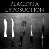 Placenta Lyposuction logo