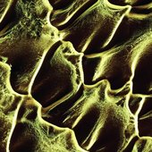 Sedimentation