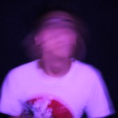 Migraine.