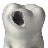 Avatar for cariousTooth