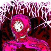 Prosopagnosia