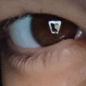 Avatar di BrokePea