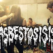Asbestosisis 