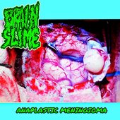 Anaplastic Meningioma