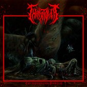 Estrangulamiento Umbilical