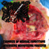 Examples of Medical Conditions Describing Necrotizing Fasciitis