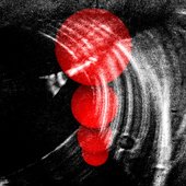 Resurrection And Immortality For All