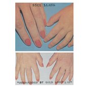 Surrounded By Gold and Dead