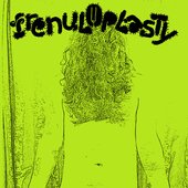 Frenuloplasty.jpg