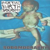 Sodomography