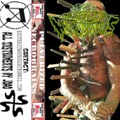 Post Mortem Hypostasis