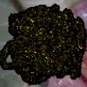 Nasopharyngeal Cancer logo