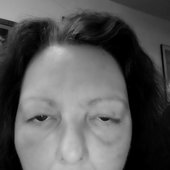 Amanda Saint Indian Disfigurement for you