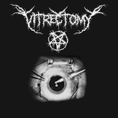 Vitrectomy Demo '17