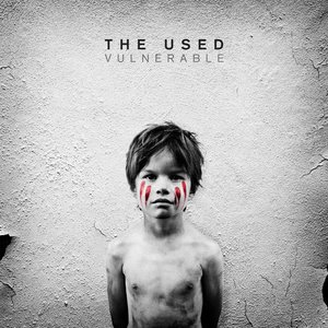 “Vulnerable (Deluxe Version)”的封面