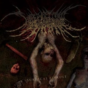 Bild für 'Surgical Assault (EP)'