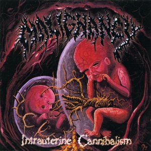 'Intrauterine Cannibalism'の画像