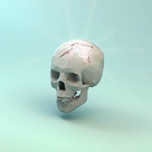 Image for 'Braincase (Deluxe)'