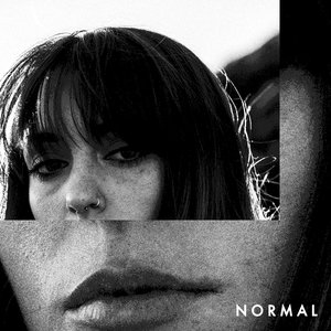 Image pour 'Normal'