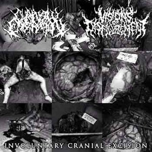 Image for 'Involuntary Cranial Excision (Split)'