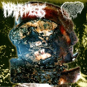 “Chronic Ulcerative Colitis / Full Adipocere Process on Bloated Corpse”的封面