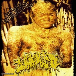 Image for 'Chronic Infections'