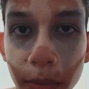 icaroyl