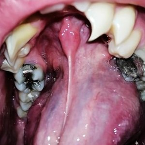 Immagine per 'Bruised Grills Eternal Tears'