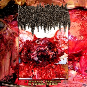 Изображение для 'A Festering Combustion of Faceless Mangles'
