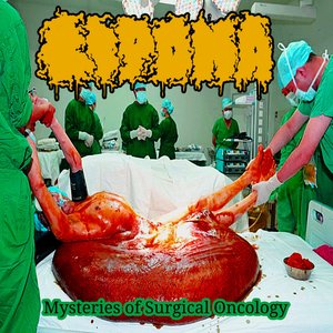 “Mysteries of Surgical Oncology”的封面