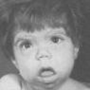 Image pour 'Escarres'