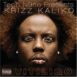 Image for 'Vitiligo'