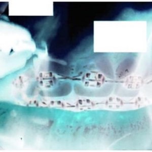 Image for 'AD0RKEN'